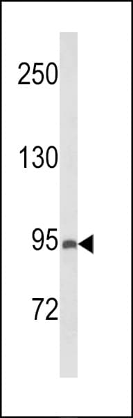 Polyclonal Rabbit anti-Human PREX1 / P-REX1 Antibody (aa567-594, WB)
