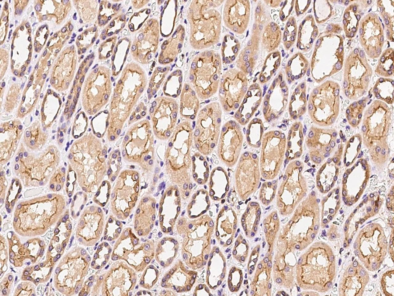 Polyclonal Rabbit anti-Human FN3KL / FN3KRP Antibody (IHC, WB)