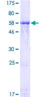 Human LRRC39 Protein (Recombinant GST)