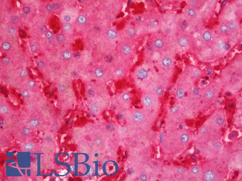 IHC-plus™ Polyclonal Rabbit anti-Human FTH1 / Ferritin Heavy Chain Antibody (aa154-183, IHC, WB)