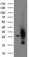 AK4 / Adenylate Kinase 4 Antibody (clone OTI3E1)
