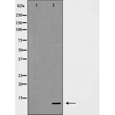 Polyclonal Rabbit anti-Human S100A10 Antibody (IHC, WB)