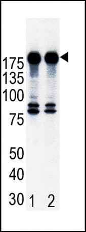 Polyclonal Rabbit anti-Human ERBB2 / HER2 Antibody (aa21-52, IHC, WB)