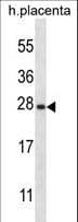 Polyclonal Rabbit anti-Human SNAP23 / SNAP-23 Antibody (aa170-199, IHC, WB)