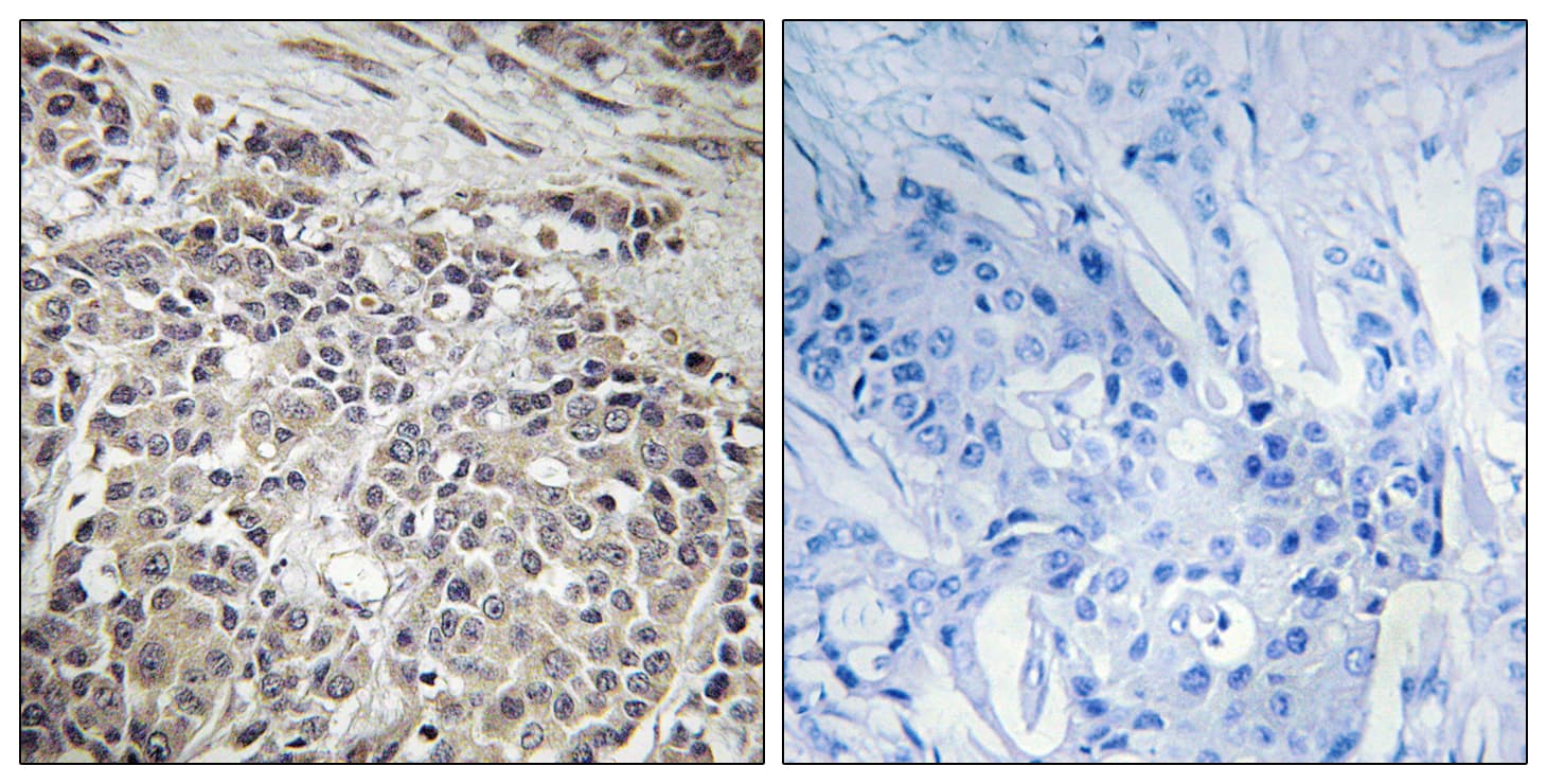 PRKAA1 / AMPK Alpha 1 Antibody (aa451-500)