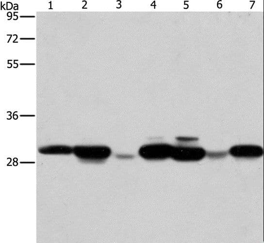 Polyclonal Rabbit anti-Human AK2 / Adenylate Kinase 2 Antibody (IHC, WB)