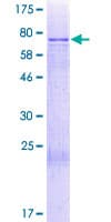 Human CCDC130 Protein (Recombinant GST)