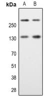 SPTAN1 / Alpha Fodrin Antibody (Internal)