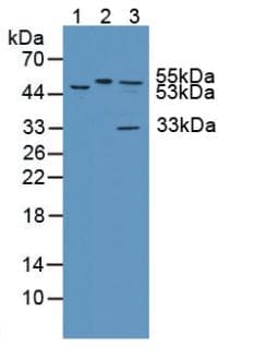 KATNA1 Antibody (aa260-491)