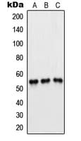 PFKFB1+4 Antibody (Internal)
