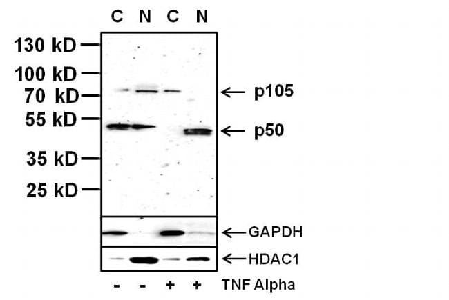 Monoclonal Mouse anti-Human NFKB1 / NF-Kappa-B Antibody (clone 5D10D11, IHC, IF, WB)