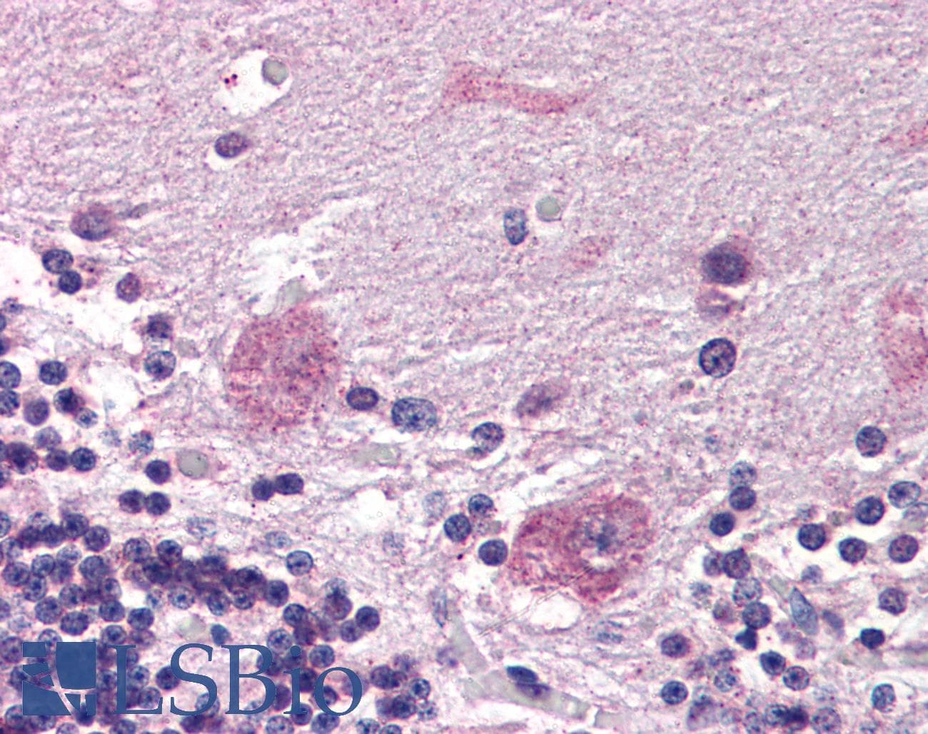 IHC-plus™ PPP2R3A / PR130 Antibody (aa1073-1085)