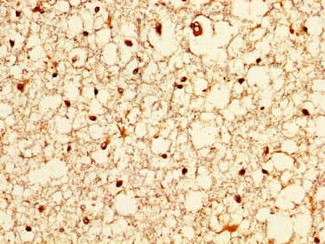 ZIC4 Antibody