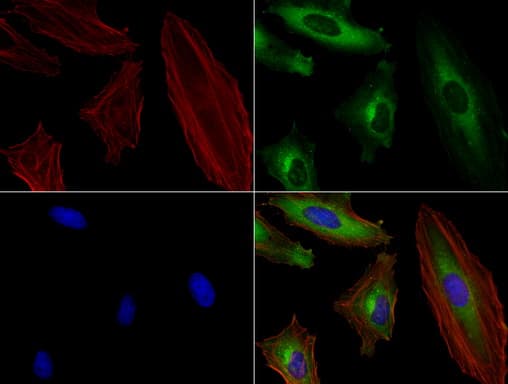 Monoclonal Mouse anti-Human SQSTM1 Antibody (clone UMAB12, Carrier-free, IHC, IF, WB)