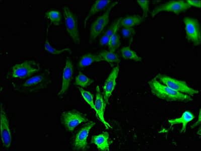 T2R13 / TAS2R13 Antibody