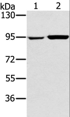 PYGL Antibody