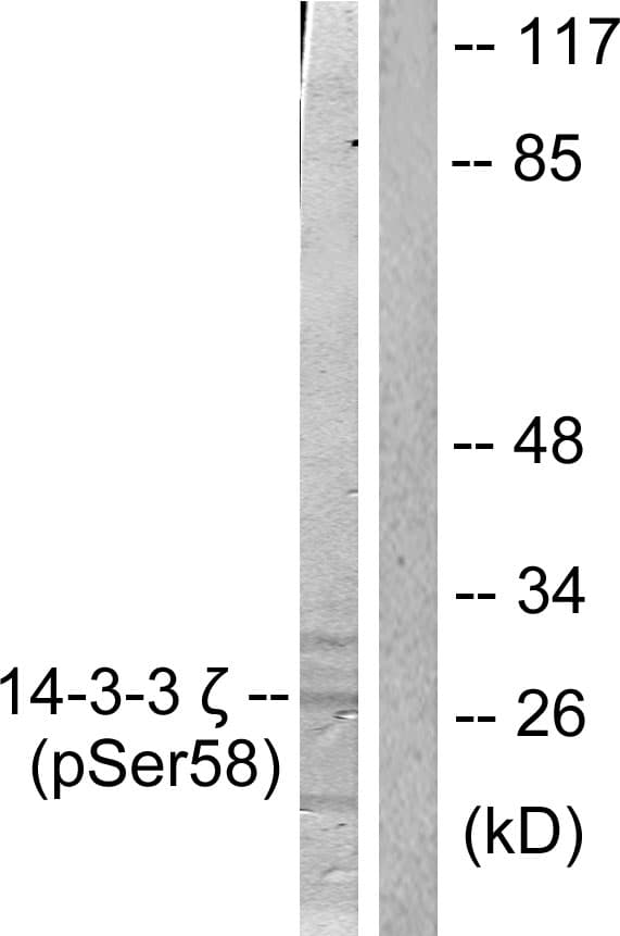 YWHAZ / 14-3-3 Zeta Antibody (phospho-Ser58)