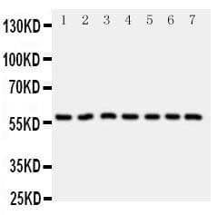 CYP11B1 Antibody (aa436-450)