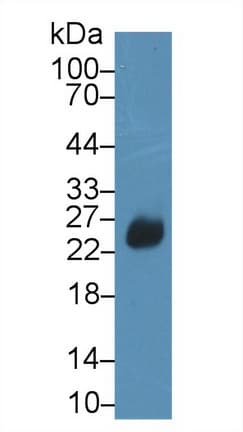 DFFA / ICAD / DFF45 Antibody (aa19-262)