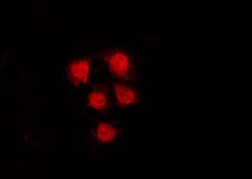 CDK17 / PCTK2 / PCTAIRE2 Antibody