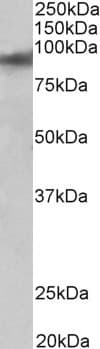 IHC-plus™ Polyclonal Goat anti-Human ZNF652 Antibody (aa594-606, IHC, WB)