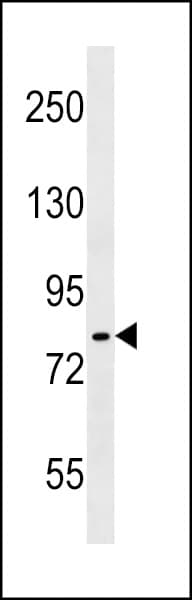 Polyclonal Rabbit anti-Human CHUK / IKKA / IKK Alpha Antibody (aa155-184, WB)