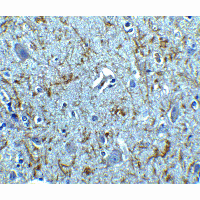 CLU / Clusterin Antibody