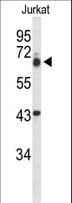 TLE1 / TLE 1 Antibody (aa199-228)