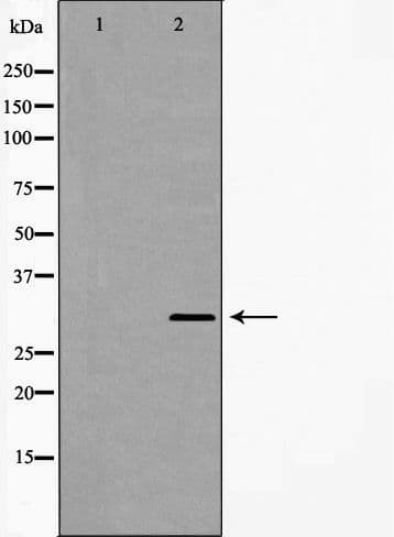 Polyclonal Rabbit anti-Human GCLM Antibody (IHC, WB)