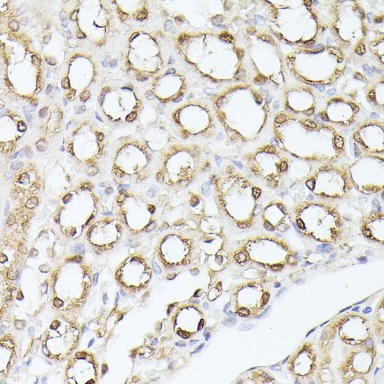 TPI1 / TPI Antibody