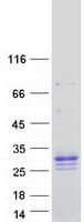 Human PRADC1 Protein (Recombinant Myc-DDK (Flag))