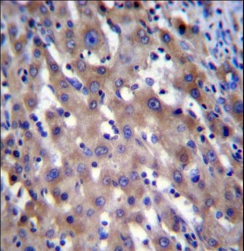 RPGR Antibody (aa744-772)