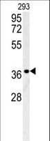 Polyclonal Rabbit anti-Human LGALS9B Antibody (aa160-188, WB)