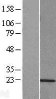 PSMB9 Protein (Over-Expression Lysate Myc-DDK (Flag))