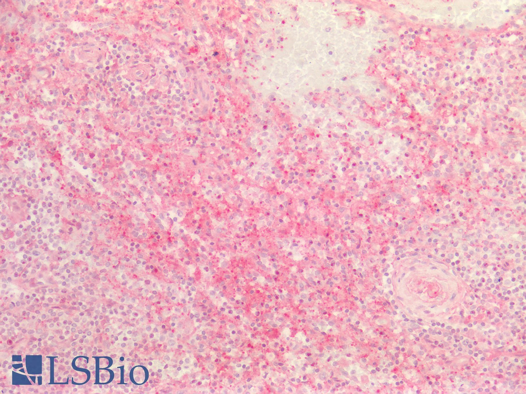 PathPlus™ Osteonectin / SPARC Antibody (clone 2B1)