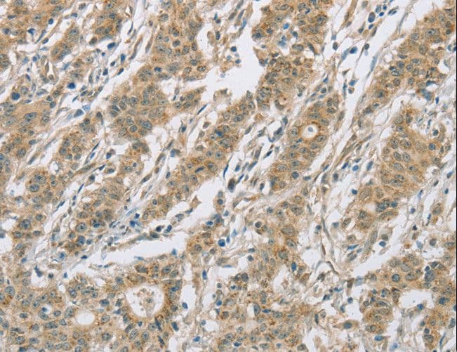 Polyclonal Rabbit anti-Human CYP2C9 / Cytochrome P450 2C9 Antibody (IHC)