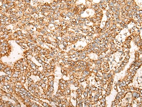 NR0B2 Antibody