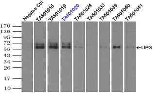 LIPG / Endothelial Lipase Antibody (clone OTI4C3)