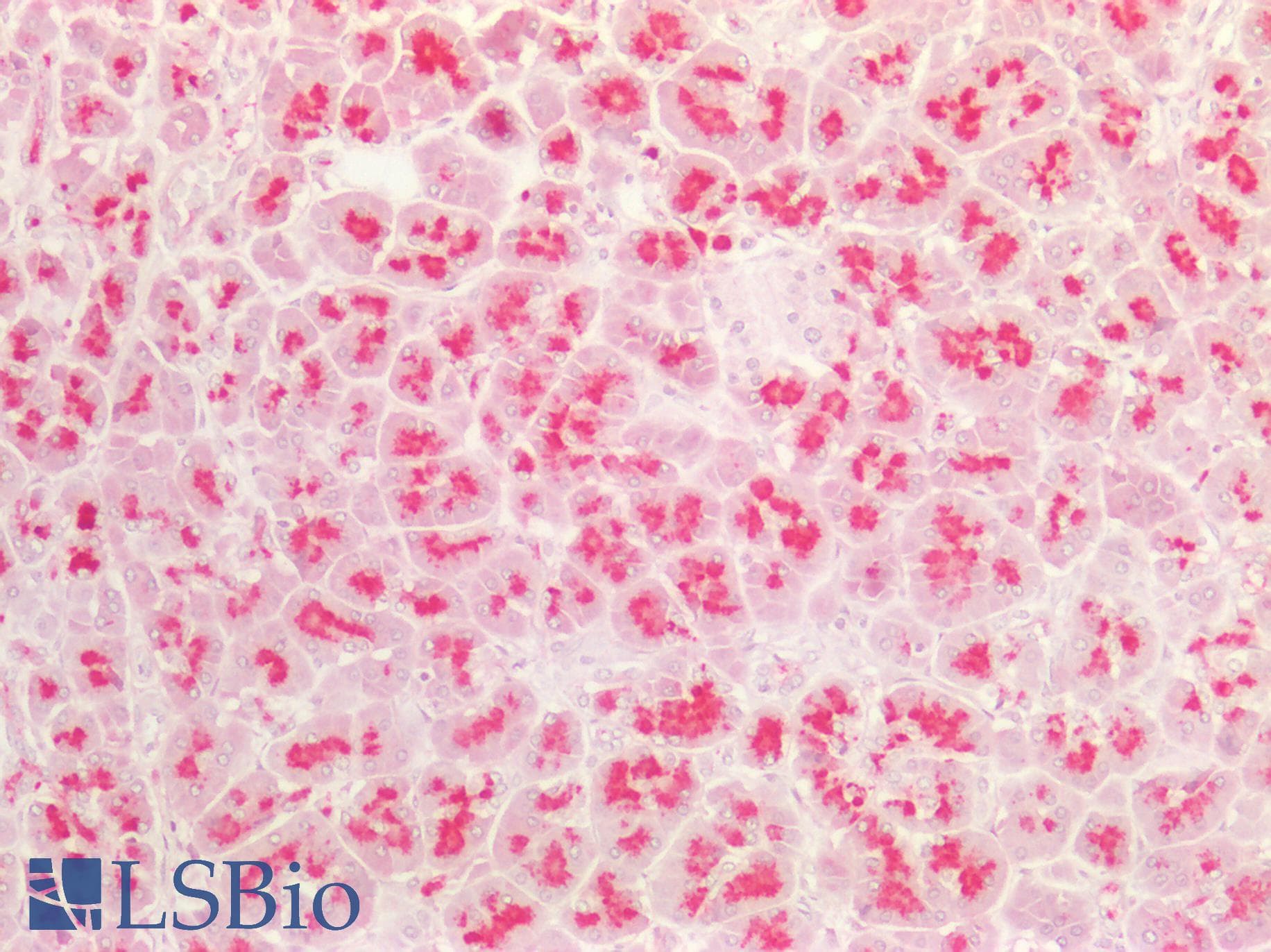 PathPlus™ EIF4EBP1 / 4EBP1 Antibody (aa35-84)