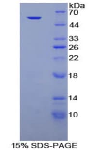 Mouse NTN1 / Netrin 1 Protein (Recombinant His-GST)