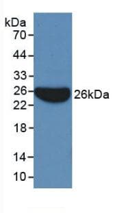 APOB / Apolipoprotein B Antibody (Biotin)
