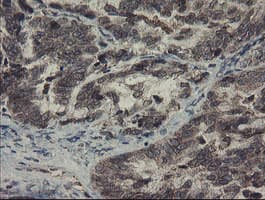 SKIL / SNO / SnoN Antibody (clone OTI1A6)