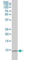 RPS27A Antibody (clone 3E2-E6)