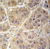 SARS2 / SYS Antibody (aa315-344)