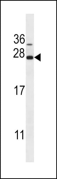 CTAG1B / NY-ESO-1 Antibody (aa1-30)