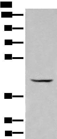 BBOX1 / BBOX Antibody