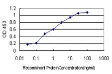 DAG1 / Dystroglycan Antibody (clone 2A3)