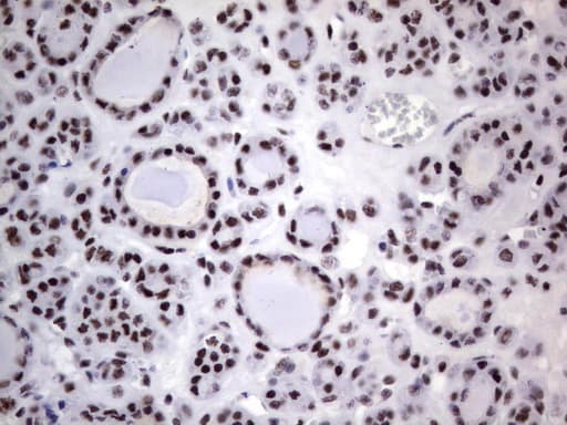 Monoclonal Mouse anti-Human DDX56 Antibody (clone UMAB152, Carrier-free, aa323-547, IHC, IF, WB)