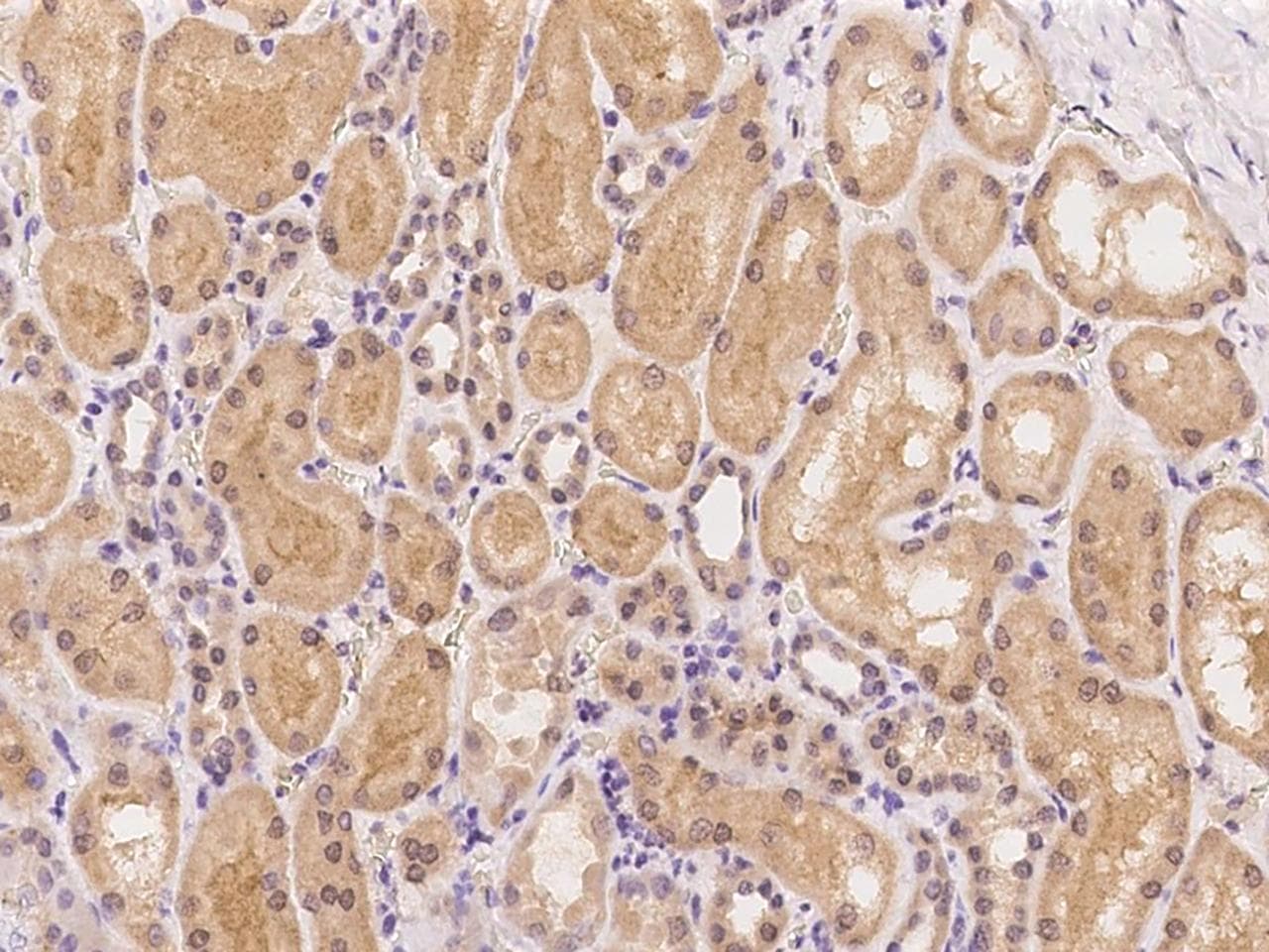 CTSA / Cathepsin A Antibody
