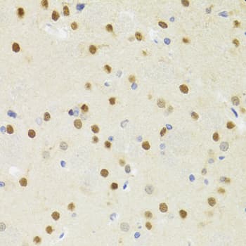 SMYD1 Antibody
